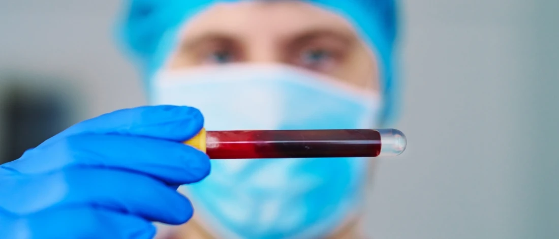 A scientist checking a blood sample in relation to a foodborne illness